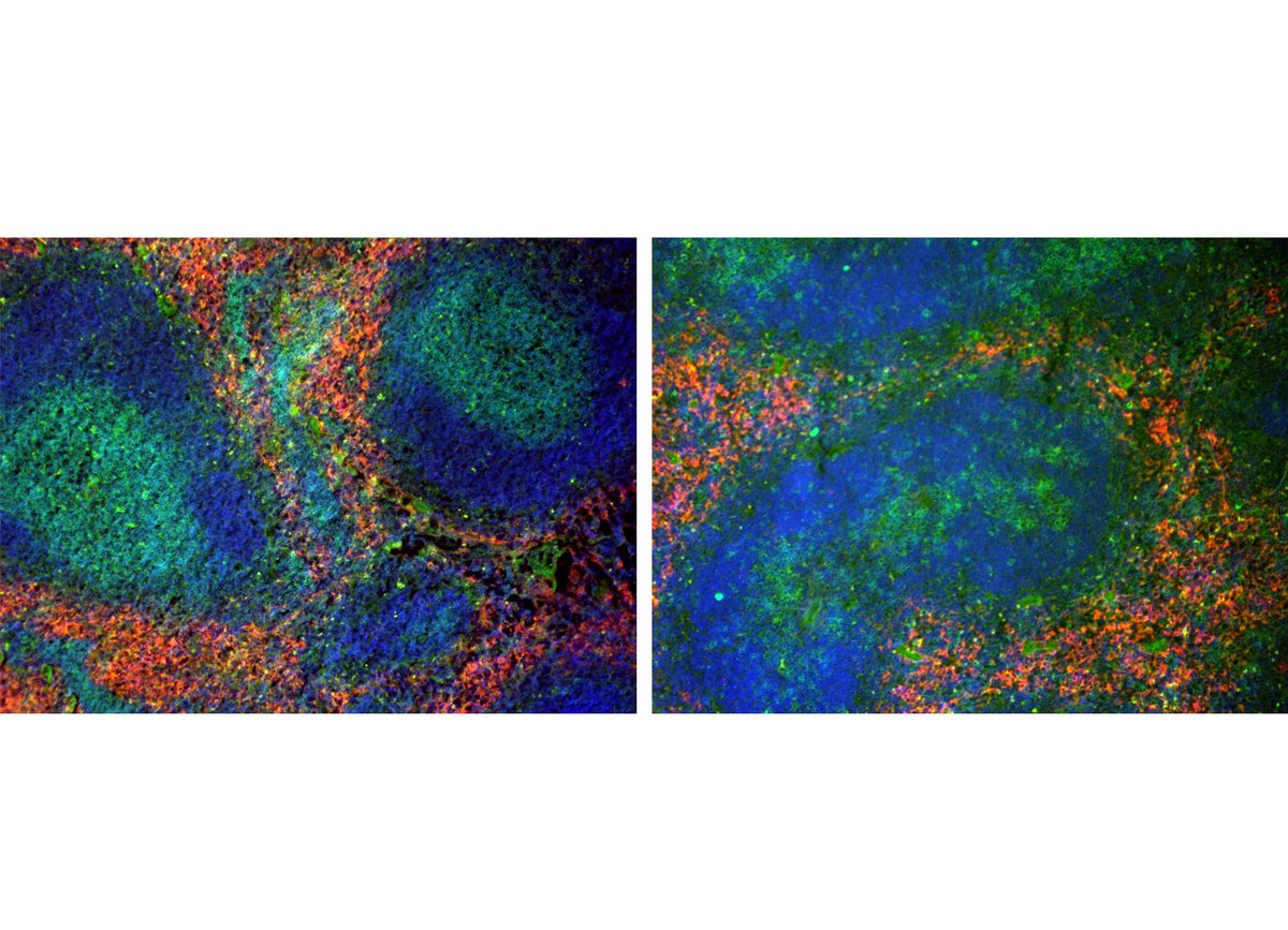 Detection of immune cells using specific antibodies in tissue sections of the spleen of wild type animals (left panel) and mice with T cell-specific deletion of LRH-1 (right panel). (green: T lymphocytes, blue: B lymphozytes, red: macrophages). Copyright: Thomas Brunner
